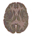 The Binding Factor runs from back to front, encompassing the whole brain.