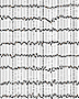 EEG traces provide the shapes of the signals Shakti uses to gently stimulate Altered States of Consciousness.