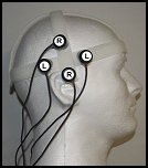 The Shakti coils, placed over the temporal lobes.