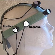 The 8 Coil Shakti with coils over the temporal and frontal lobes.