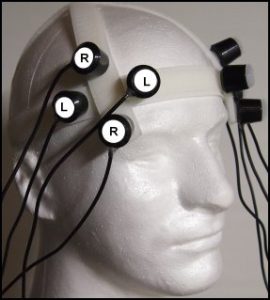 The 8 Coil Shakti, placed over the temporal-frontal area.